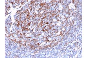Formalin-fixed, paraffin-embedded human Tonsil Dendritic stained with CD21 / CR2 Recombinant Rabbit Monoclonal Antibody (CR2/3124R). (Rekombinanter CD21 Antikörper  (AA 142-240))