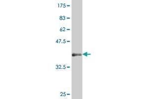 Western Blot detection against Immunogen (37. (HHEX Antikörper  (AA 133-237))
