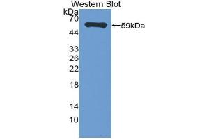 Western Blotting (WB) image for anti-Membrane-Spanning 4-Domains, Subfamily A, Member 1 (MS4A1) (AA 6-251) antibody (ABIN7442675)