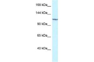 WB Suggested Anti-PKN2 Antibody Titration: 1.