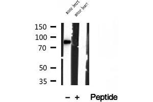 Western blot analysis of extracts of mouse heart tissue, using YME1L1 antibody. (YME1L1 Antikörper  (C-Term))