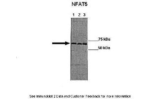 Lanes: Lane 1:241 µg HT 29 lysate blocked with 5 % FBS Lane 2: 041 µg HT 29 lysate blocked with no FBS Lane 3: 041 µg HT-29 lyaste blocked with no PBS + 100 mM NaCl Primary Antibody Dilution: 1:0000Secondary Antibody: Goat anti-rabbit-HRP Secondary Antibody Dilution: 1:0000  Gene Name: NFAT5 Submitted by: Manuel Fresno, CBMSO (NFAT5 Antikörper  (Middle Region))