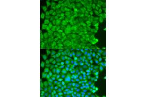 Immunofluorescence analysis of HeLa cells using SGCE antibody (ABIN5973070). (SGCE Antikörper)