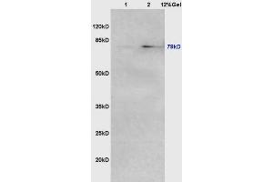 SDS-PAGE (SDS) image for anti-Angiogenic Factor with G Patch and FHA Domains 1 (AGGF1) (AA 461-560) antibody (ABIN722380)