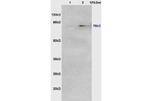 Lane 1: mouse lung lysates Lane 2: mouse intestine lysates probed with Anti VG5Q/AGGF1 Polyclonal Antibody, Unconjugated (ABIN722380) at 1:200 in 4 °C. (AGGF1 Antikörper  (AA 461-560))