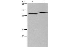 Western Blot analysis of Human fetal brain and Mouse brain tissue using EGR4 Polyclonal Antibody at dilution of 1:400