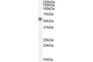 Western Blotting (WB) image for anti-Family with Sequence Similarity 181, Member B (FAM181B) (N-Term) antibody (ABIN2791534) (FAM181B Antikörper  (N-Term))