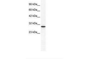 Image no. 1 for anti-Annexin A5 (ANXA5) (AA 71-120) antibody (ABIN202233) (Annexin V Antikörper  (AA 71-120))