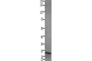 Gel: 10+12 % SDS-PAGE, Lysate: 30 μg, Lane: Human liver cancer tissue, Primary antibody: ABIN7192693(STMN2/STMN3/STMN4 Antibody) at dilution 1/450, Secondary antibody: Goat anti rabbit IgG at 1/8000 dilution, Exposure time: 1 minute (STMN2/STMN3/STMN4 Antikörper)