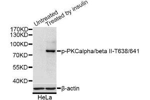 Western blot analysis of extracts of HeLa cells, using Phospho-PRKCB-T641 antibody (ABIN2987563) at 1/1000 dilution. (PKC beta Antikörper  (pThr641))