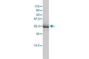 Western Blotting (WB) image for anti-Single Immunoglobulin and Toll-Interleukin 1 Receptor (TIR) Domain (SIGIRR) (AA 1-410) antibody (ABIN528393)