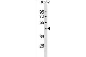 Western Blotting (WB) image for anti-Pellino E3 Ubiquitin Protein Ligase 1 (PELI1) antibody (ABIN3000532) (Pellino 1 Antikörper)