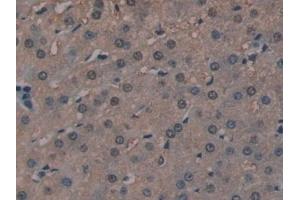 Immunohistochemistry (IHC) image for anti-Golgi Glycoprotein 1 (GLG1) (AA 1048-1145) antibody (ABIN7439525)