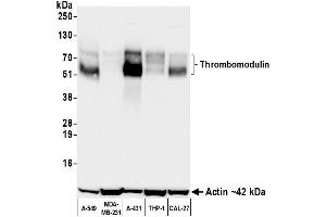 Western Blotting (WB) image for anti-Thrombomodulin (THBD) (AA 17-515) antibody (ABIN7795644)