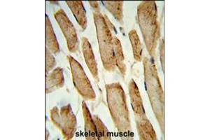 Formalin-fixed and paraffin-embedded human skeletal muscle reacted with POLG2 Antibody , which was peroxidase-conjugated to the secondary antibody, followed by DAB staining.