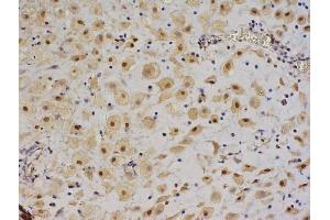 Formalin-fixed and paraffin embedded human pancreas labeled with Anti-IGF II/IGF2 Polyclonal Antibody, Unconjugated (ABIN723620), followed by conjugation to the secondary antibody and DAB staining (IGF2 Antikörper  (AA 25-51))