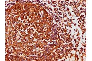 IHC image of ABIN7146858 diluted at 1:1000 and staining in paraffin-embedded human lymph node tissue performed on a Leica BondTM system.