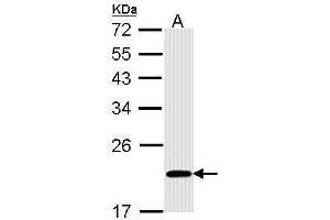 WB Image Sample (30 ug of whole cell lysate) A: A431 , 12% SDS PAGE antibody diluted at 1:1000 (BID Antikörper)