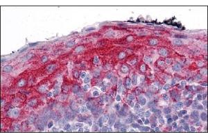 Immunohistochemistry of ZMYM4 in Human Tonsil with ZMYM4 Antibody  at 5 μg/ml. (ZMYM4 Antikörper  (C-Term))