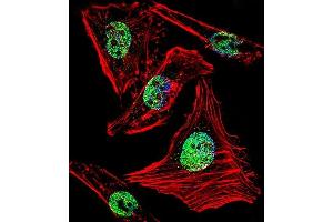 Fluorescent confocal image of Hela cell stained with ZBTB7B Antibody (C-term) (ABIN1882155 and ABIN2840762). (ZBTB7B Antikörper  (C-Term))