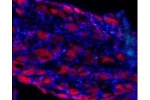 Expression of GRIA4 (GluR4) in rat DRGImmunohistochemical staining of rat frozen dorsal root ganglion (DRG) sections using Anti-GluR4 (GluA4) (extracellular) Antibody (ABIN7581895), (1:100).