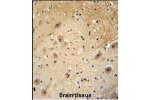 Immunohistochemistry (Paraffin-embedded Sections) (IHC (p)) image for anti-DDB1 and CUL4 Associated Factor 13 (DCAF13) (AA 369-398), (C-Term) antibody (ABIN654792)