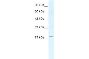 WB Suggested Anti-SOX14 Antibody Titration:  2. (SOX14 Antikörper  (Middle Region))