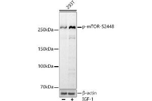 Western blot analysis of extracts of 293T cells, using Phospho-mTOR-S2448 antibody (ABIN7268435) at 1:1000 dilution. (MTOR Antikörper  (pSer2448))