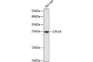 Western blot analysis of extracts of Rat eye using CPLX4 Polyclonal Antibody at dilution of 1:3000. (Complexin 4 Antikörper)