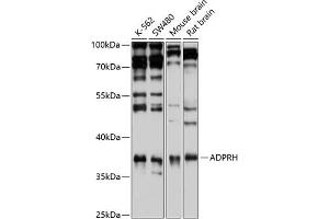 Western blot analysis of extracts of various cell lines, using ADPRH antibody (ABIN6129880, ABIN6136587, ABIN6136588 and ABIN6221872) at 1:1000 dilution. (ADPRH Antikörper  (AA 180-270))