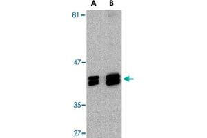 Western blot analysis of SH3GLB1 in HeLa cell lysate with SH3GLB1 polyclonal antibody  at (A) 1 and (B) 2 ug/mL . (SH3GLB1 Antikörper  (C-Term))