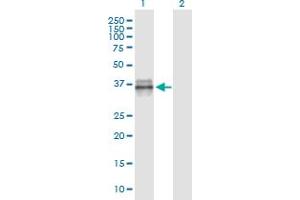 Western Blot analysis of IGFBP3 expression in transfected 293T cell line by IGFBP3 monoclonal antibody (M02), clone 2G6. (IGFBP3 Antikörper  (AA 182-291))