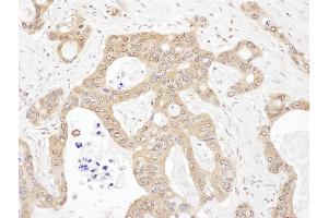 anti-Leucyl-tRNA Synthetase (LARS) (AA 250-300) antibody