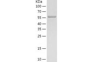 Western Blotting (WB) image for phosphoglycerate Dehydrogenase (PHGDH) (AA 1-533) protein (His tag) (ABIN7284425) (PHGDH Protein (AA 1-533) (His tag))