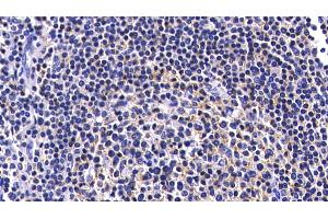 Immunohistochemistry (IHC) image for anti-Caspase 8 (CASP8) (AA 217-384) antibody (ABIN7432745)