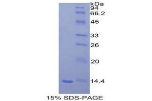 SDS-PAGE (SDS) image for beta-2-Microglobulin (B2M) (AA 22-119) protein (His tag) (ABIN1078958) (beta-2 Microglobulin Protein (AA 22-119) (His tag))