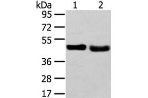 Western Blot analysis of 231 cell and Human fetal liver tissue using TRIB2 Polyclonal Antibody at dilution of 1/450 (TRIB2 Antikörper)