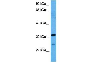 Host:  Rabbit  Target Name:  GJB1  Sample Tissue:  Mouse Spleen  Antibody Dilution:  1ug/ml (GJB1 Antikörper  (Middle Region))