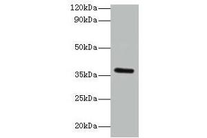 Western blot All lanes: BRCC3 antibody at 2 μg/mL + K562 whole cell lysate Secondary Goat polyclonal to rabbit IgG at 1/15000 dilution Predicted band size: 37, 34, 24, 29 kDa Observed band size: 37 kDa (BRCC3 Antikörper  (AA 14-316))