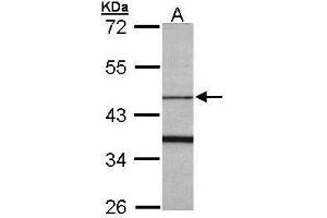 WB Image Sample (30 ug of whole cell lysate) A: Raji 10% SDS PAGE antibody diluted at 1:1000 (FBXO15 Antikörper)