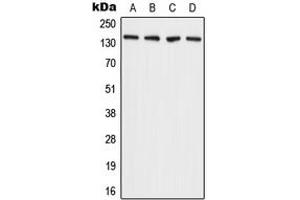 Western blot analysis of ADAMTS2 expression in A431 (A), MCF7 (B), SP2/0 (C), H9C2 (D) whole cell lysates. (Adamts2 Antikörper  (C-Term))
