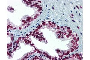 Anti-SP1 antibody IHC of human prostate. (SP1 Antikörper  (AA 89-199))