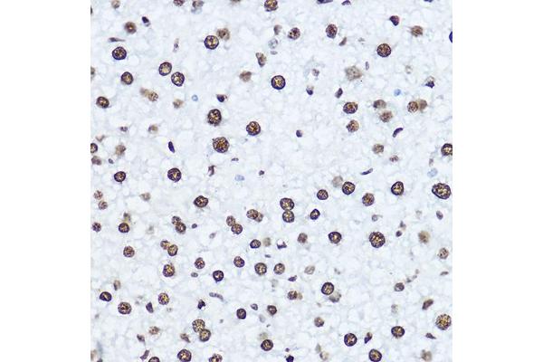 Histone H1 Antikörper  (AA 1-105)