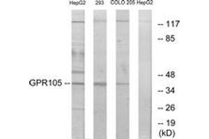 Western blot analysis of extracts from 293/COLO205/HepG2 cells, using GPR105 Antibody. (P2RY14 Antikörper  (AA 146-195))
