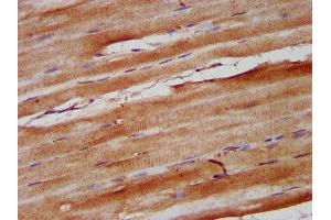 IHC image of ABIN7161101 diluted at 1:600 and staining in paraffin-embedded human skeletal muscle tissue performed on a Leica BondTM system. (Nebulin Antikörper  (AA 245-373))