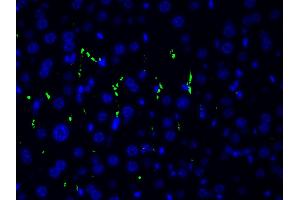 ABIN6267554 at 1/200 staining human gastric tissue sections by ICC/IF. (LIM Domain Kinase 1 Antikörper  (pThr508))