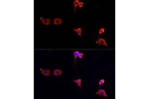 Immunofluorescence analysis of PC12 cells using MTOR antibody. (MTOR Antikörper  (AA 2388-2487))