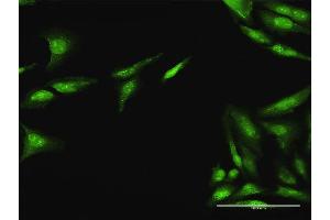 Immunofluorescence of purified MaxPab antibody to CDC25A on HeLa cell. (CDC25A Antikörper  (AA 1-524))