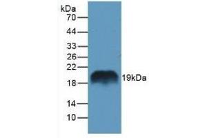 Detection of REG1a in Rat Pancreas Tissue using Polyclonal Antibody to Regenerating Islet Derived Protein 1 Alpha (REG1a) (REG1A Antikörper  (AA 10-165))
