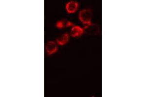 ABIN6266687 staining MCF-7 cells by IF/ICC.